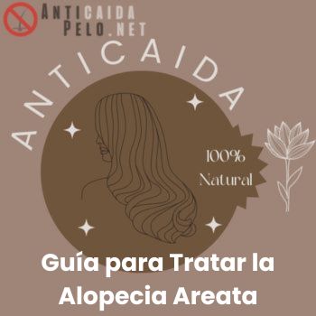 Guía para Tratar la Alopecia Areata